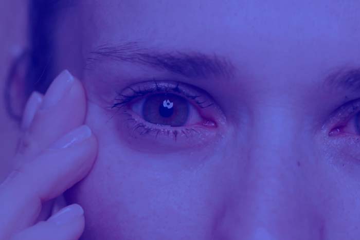Sindrome-de-Sjogren